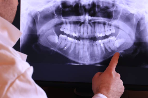 Best Emergency Treatment for Dental Infections or Abscesses in Kaaawa, HI